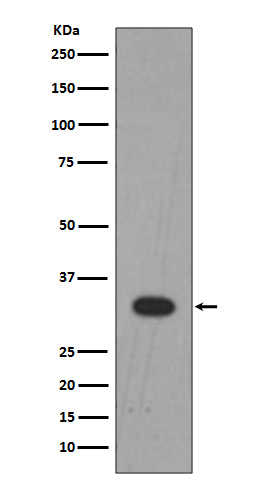 Lin28B Rabbit mAb[56087]