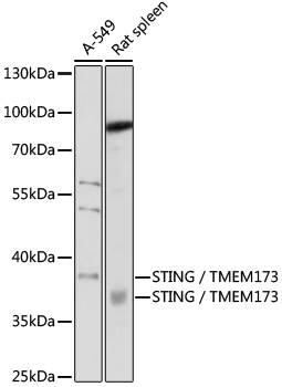 STING / TMEM173 Rabbit Polyclo
