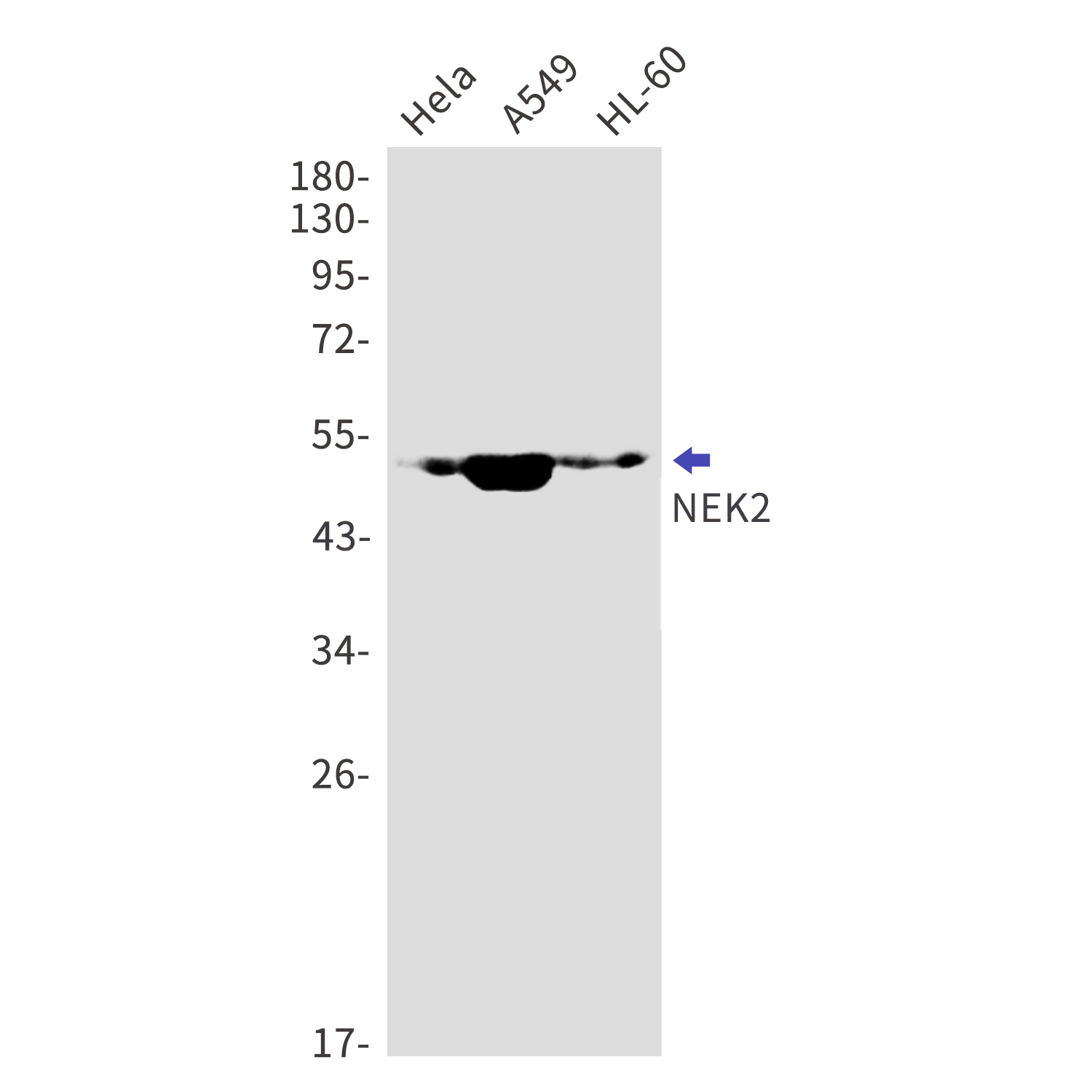 NEK2 Rabbit mAb[52819]