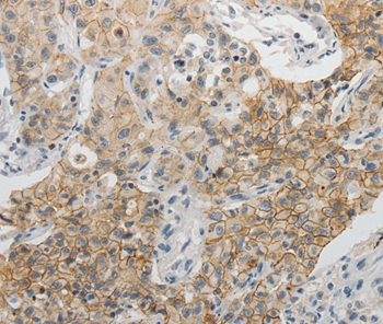 CDH3 Antibody[35871]