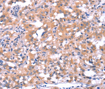 FAT1 Antibody[37566]