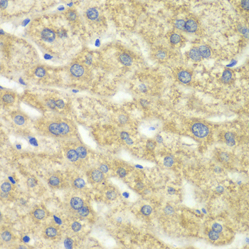 DLD Rabbit Polyclonal Antibody
