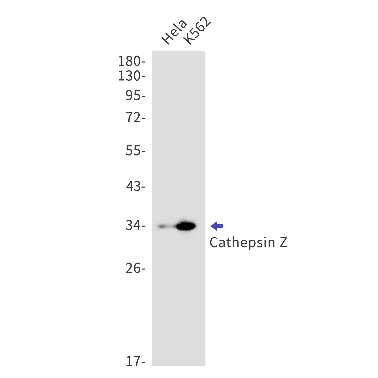 Cathepsin Z Rabbit mAb[52196]