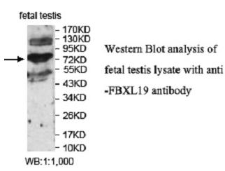 FBXL19 Antibody[40047]