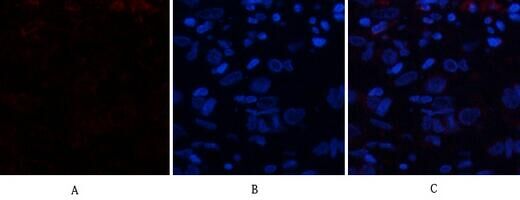 CD63 Polyclonal Antibody[44012