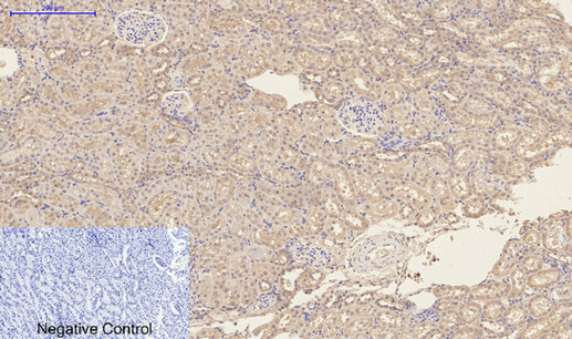 CD23 (3D1) Mouse mAb[26203]