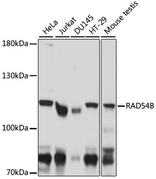 RAD54B Rabbit Polyclonal Antib
