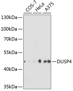 DUSP4 Rabbit Polyclonal Antibo