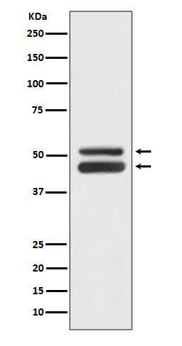 JNK1/JNK3 Rabbit mAb[56119]