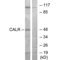CALR Antibody[33733]