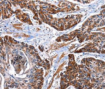 ITGA7 Antibody[36933]