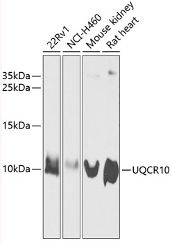 UQCR10 Rabbit Polyclonal Antib