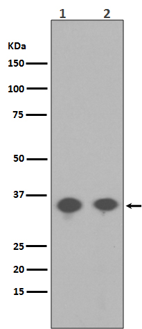 PP2A alpha (Phospho-Tyr307) Ra