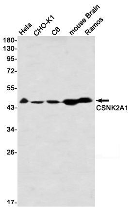 CSNK2A1 Rabbit mAb[52745]
