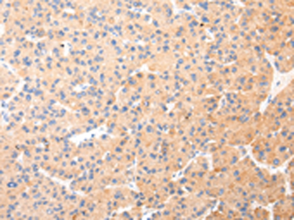 KRT20 Antibody[43218]