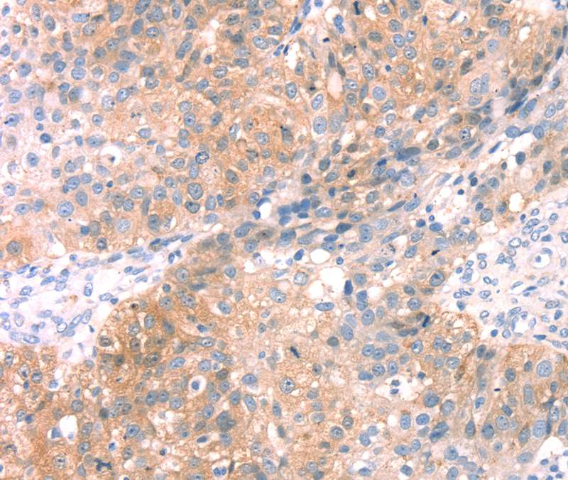 SNAP23 Antibody[40111]