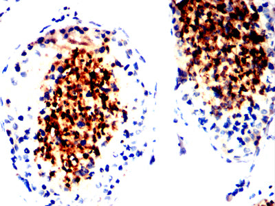 IZUMO4 Mouse mAb[63801]