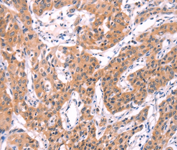 SERPINA5 Antibody[35991]