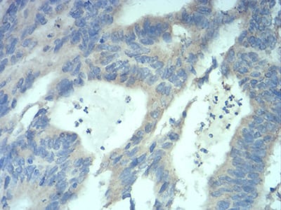 MECP2 Mouse mAb[63923]
