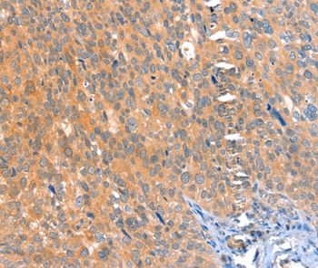 ACOX3 Antibody[36022]
