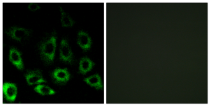 S2P Polyclonal Antibody[48919]