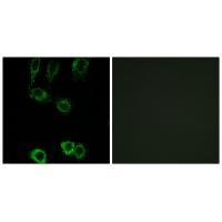 CNN2 Antibody[34522]