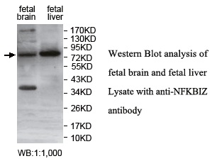 NFKBIZ Antibody[39753]