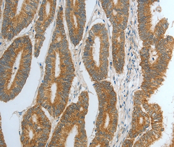 DNAJC10 Antibody[35859]