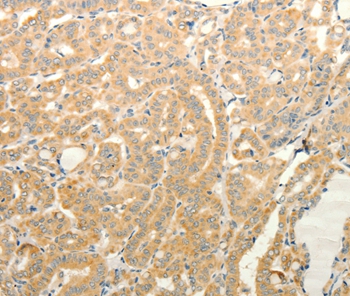 TPH1 Antibody[35965]
