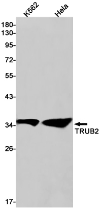 TRUB2 Rabbit mAb[52634]