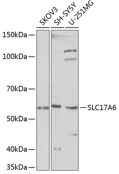 SLC17A6 Rabbit Polyclonal Anti