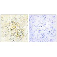 TMEPA Antibody[34019]