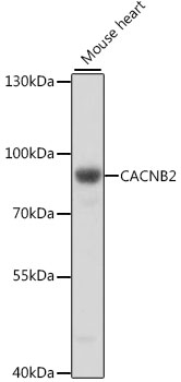 CACNB2 Rabbit Polyclonal Antib