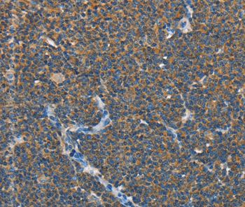 SEPT9 Antibody[35642]