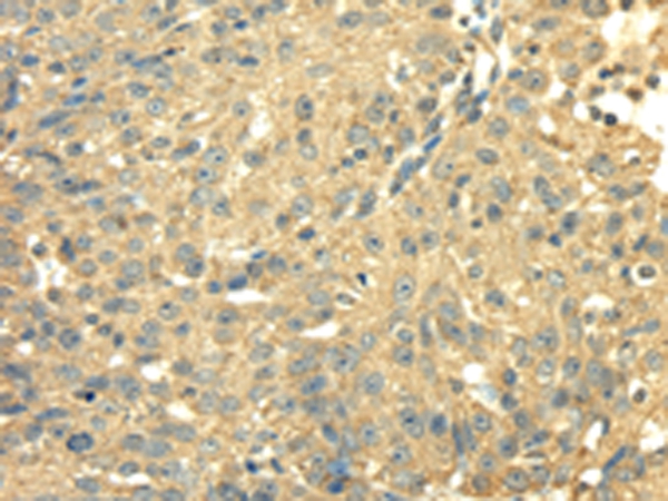 SDHA Antibody[42746]