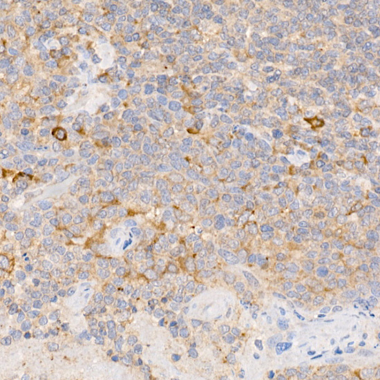 C19orf10 antibody[38186]