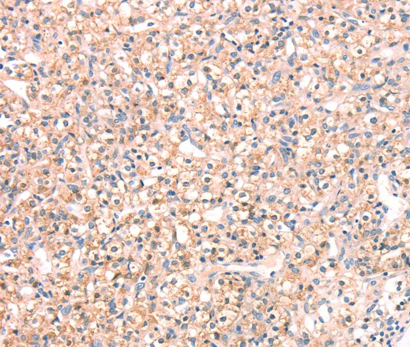 SNAP23 Antibody[40111]