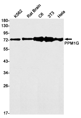 PPM1G Rabbit mAb[52519]