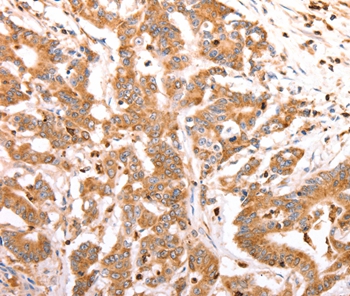 CELSR2 Antibody[37302]