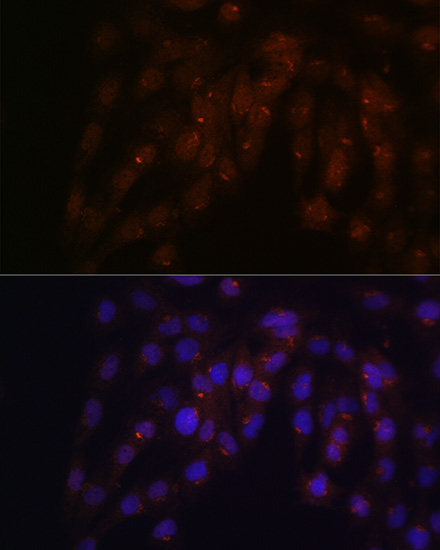 CUX1 Rabbit Polyclonal Antibod