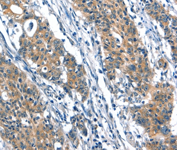 A4GALT Antibody[37407]