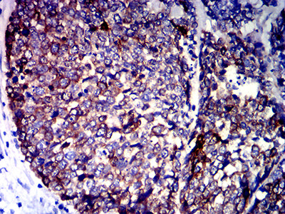 CDKN1A Mouse mAb[63449]