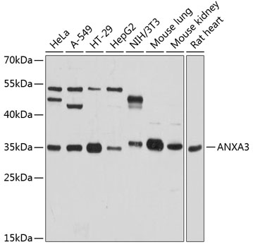 ANXA3 Rabbit Polyclonal Antibo
