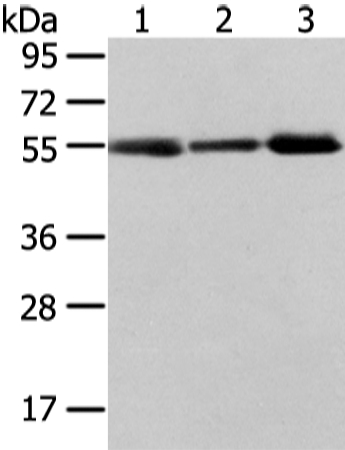 XKRX Antibody[43203]