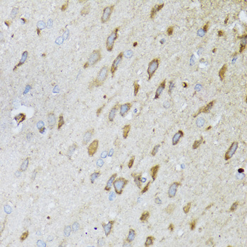 MT-ND5 Rabbit Polyclonal Antib