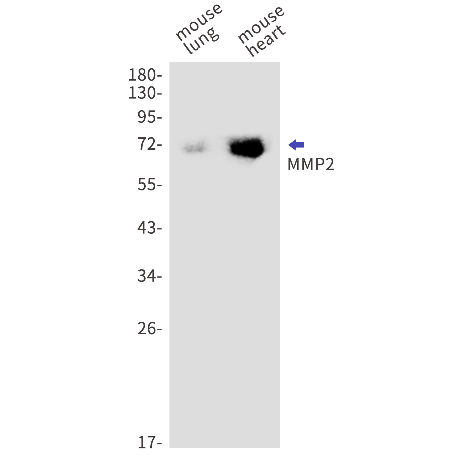 MMP2 Rabbit mAb[52426]