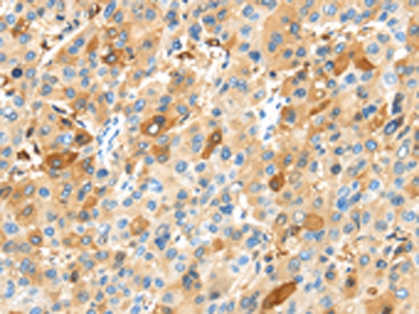 MAP3K10 Antibody[43105]