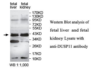 DUSP11 Antibody[39758]