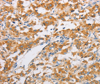 FARSB Antibody[36152]
