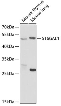 ST6GAL1 antibody[38688]